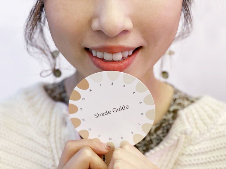 牙黃急救😬編輯實試家用藍光美白牙齒神器＋用後感！另推介2款高效去黃產品