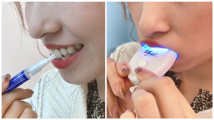 牙黃急救😬編輯實試家用藍光美白牙齒神器＋用後感！另推介2款高效去黃產品