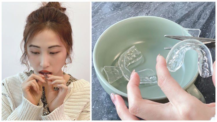 牙黃急救😬編輯實試家用藍光美白牙齒神器＋用後感！另推介2款高效去黃產品