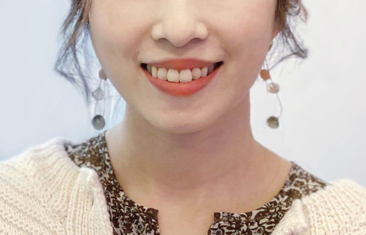 牙黃急救😬編輯實試家用藍光美白牙齒神器＋用後感！另推介2款高效去黃產品