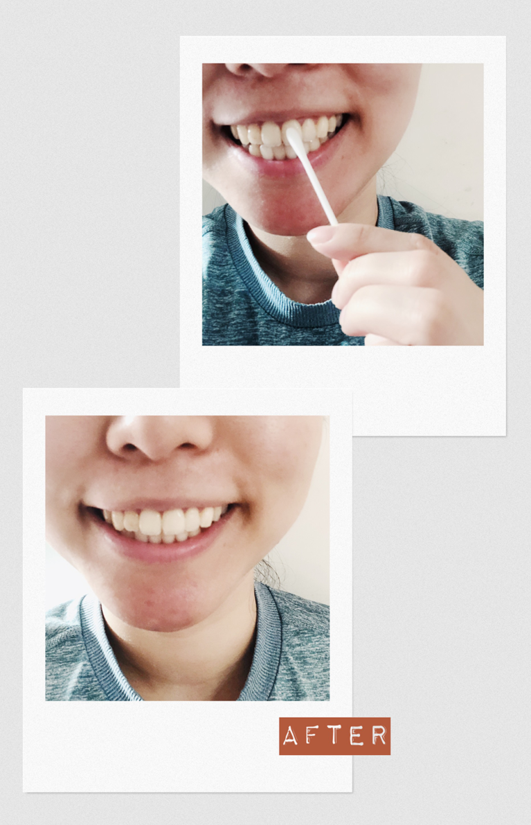 Dental Cleaning 美白牙齒棉花棒