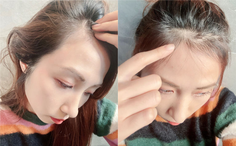 脫髮、開叉怎麼辦？好用護髮產品：Hairmax、The Public Organic、OMG