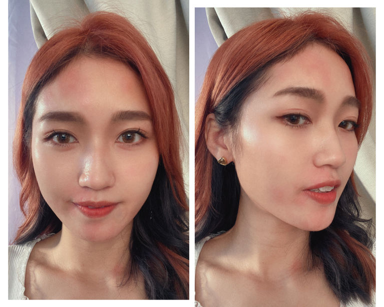 【編輯大膽實測家用微針滾輪】爆血？又好又腫？微針滾輪好處+注意事項你要知 ⚠️