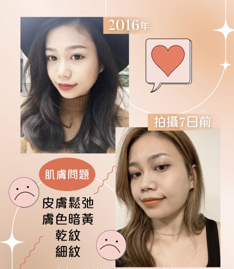 5年前肌膚狀態