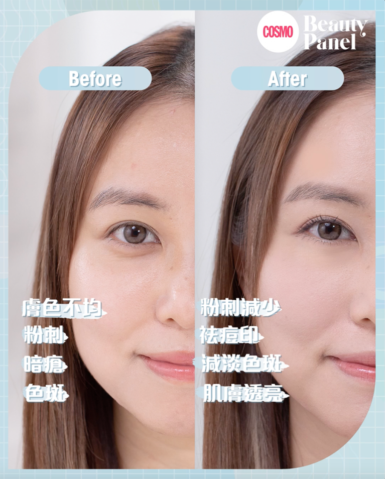 Swiss Organic透亮淡斑精華素 Before & After