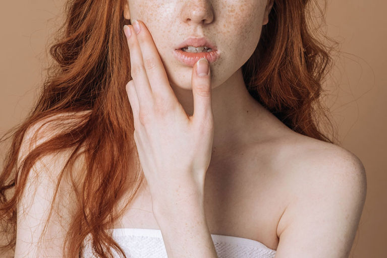 色斑形成的原因