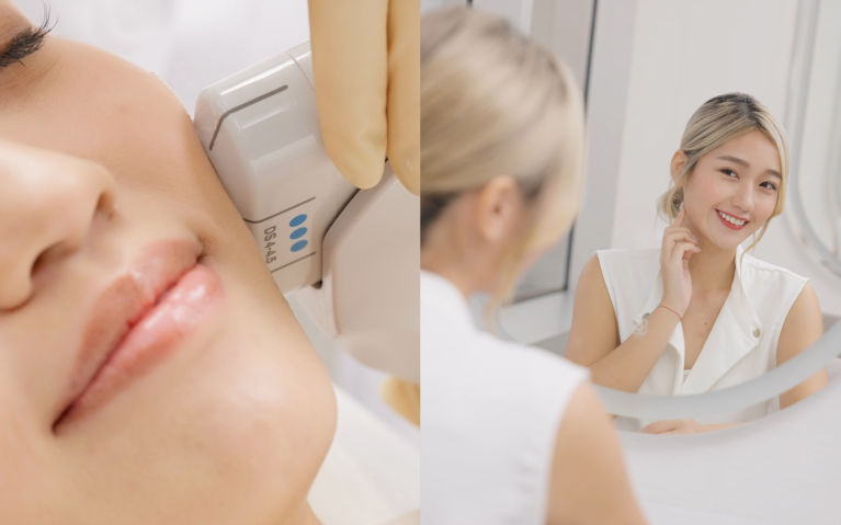 頂級韓流明星用家熱捧｜編輯實試Ultherapy® 微聚焦超聲波拉提療程 — 提升！緊緻！還原童顏臉！